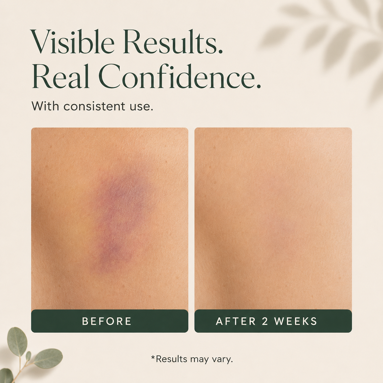 Purelyora Bruise Repair & Skin-Strengthening Cream